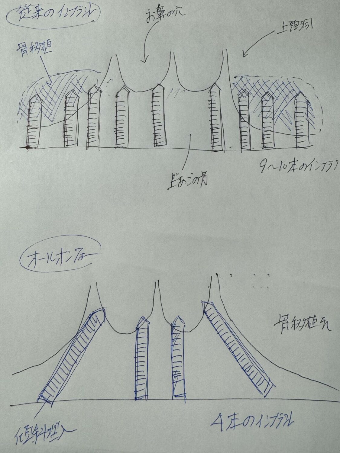 院長がオールオン4に関する本を執筆中です。