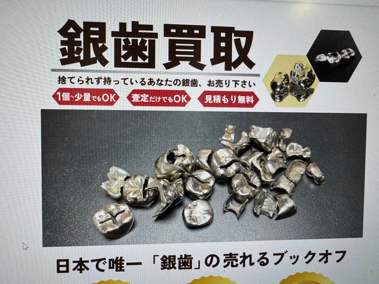 【金属価格高騰が引き起こす?】歯科医院での廃冠盗難事件に思うこと|岡山の歯科医が語る歯科医療の倫理と信頼