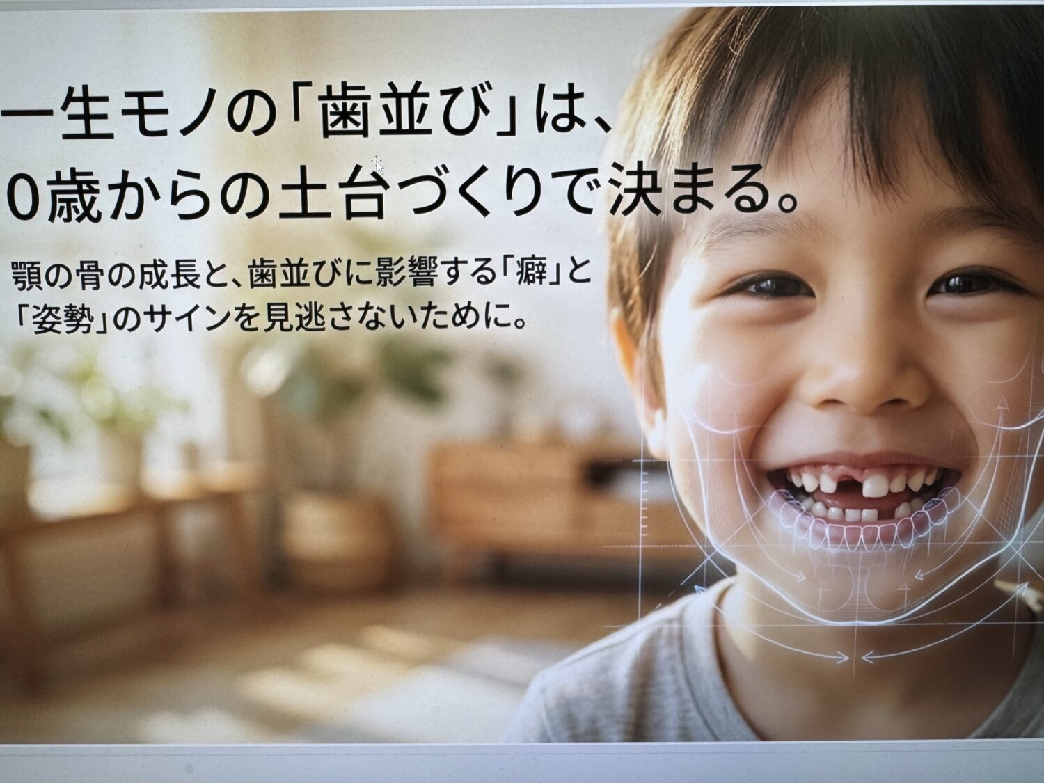 子どもの歯は一生の財産！その未来は親御さんの行動で決まります