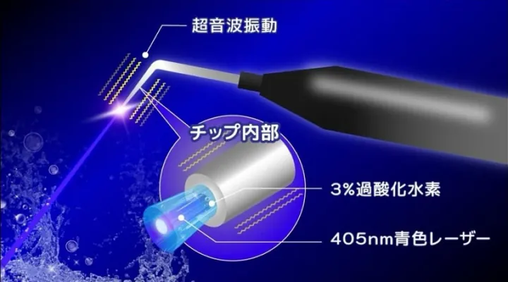 ブルーラジカルP-01のチップ内部構造（超音波振動・3%過酸化水素・405nm青色レーザー）