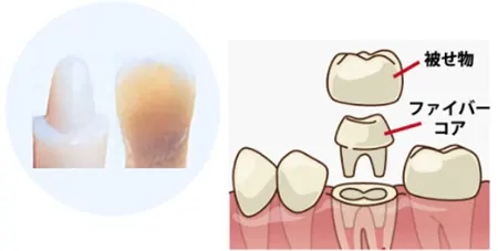 ファイバーコア