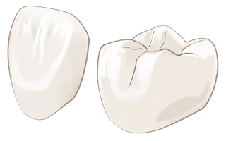 オールセラミックス