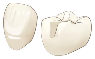 オールジルコニア